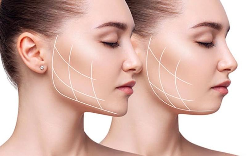 Achieving a Defined Jawline How Chewing Gum Can Help